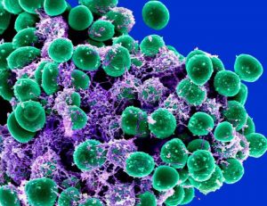 MRSA & Staph Infections: Reasons to Practice Good Hygeine