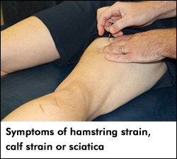 Symptoms of hamstring strain, calf strain or sciatica