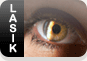 LASIK evaluations at the UHC Vision Clinic